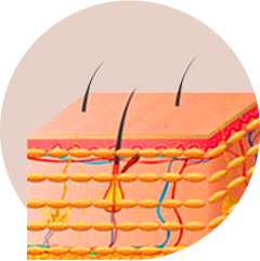 Layered injection, smooth surface