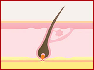 Before hair growth treatment