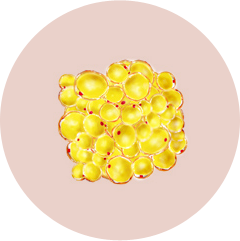 Conventional fat grafting