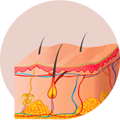 Large volume in one layer, uneven surface