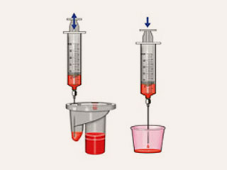 3. Extraction and immediate reinjection