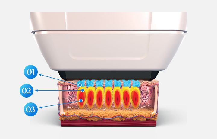 Sofwave — clinic photo
