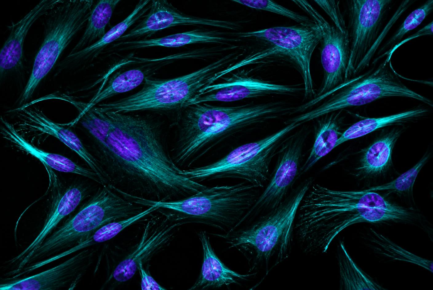 Microscope view of cultured mesenchymal stem cells fluorescing teal and violet on black